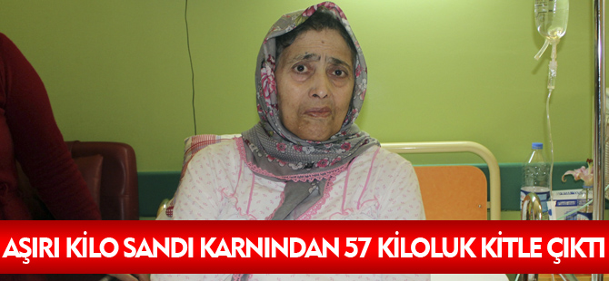 AŞIRI KİLO SANDI KARNINDAN 57 KİLOLUK KİTLE ÇIKTI