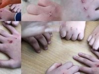 “KANLI PARA” TEHLİKESİ GÜMÜŞHANE’YE DE BULAŞTI
