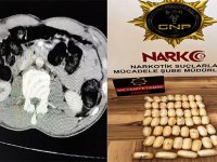 YABANCI UYRUKLU ŞAHSIN MİDESİNDE 53 PARÇA UYUŞTURUCU YAKALANDI