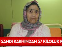 AŞIRI KİLO SANDI KARNINDAN 57 KİLOLUK KİTLE ÇIKTI